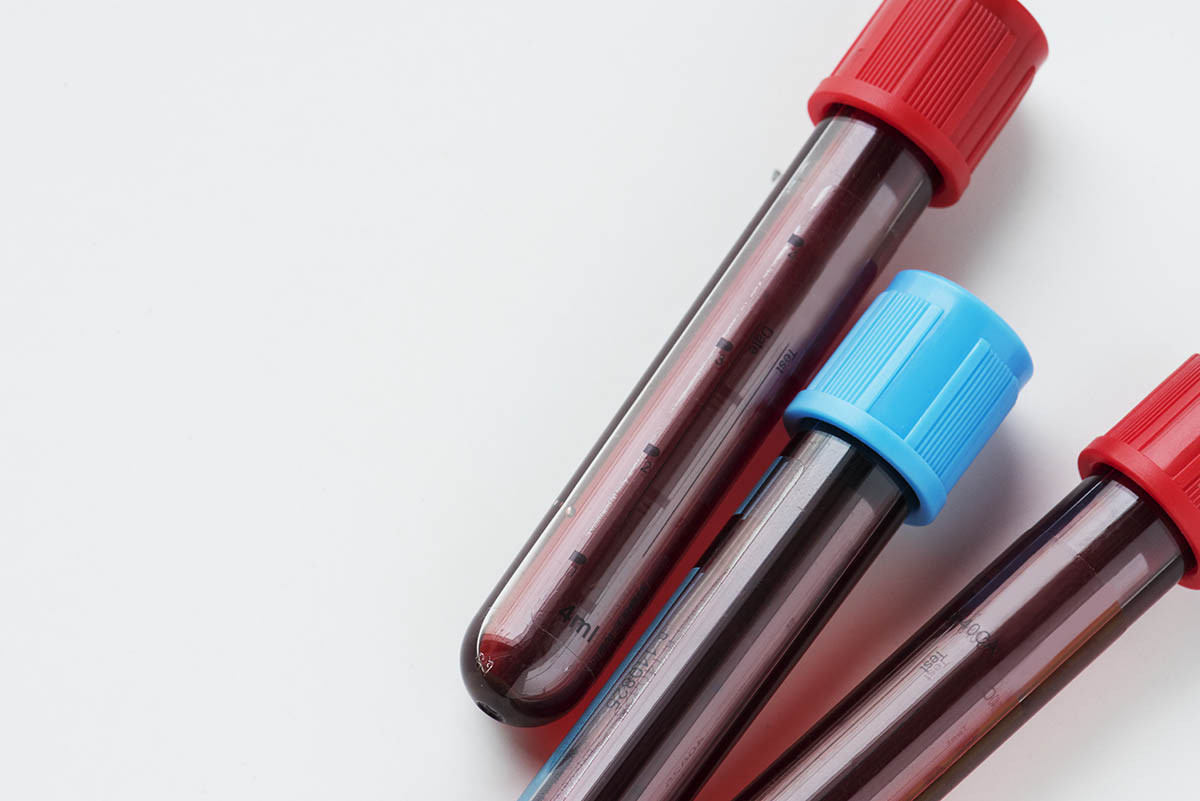 Centro Médico de Especialidades: Hematologia | Oeste Saúde - Planos de Saúde